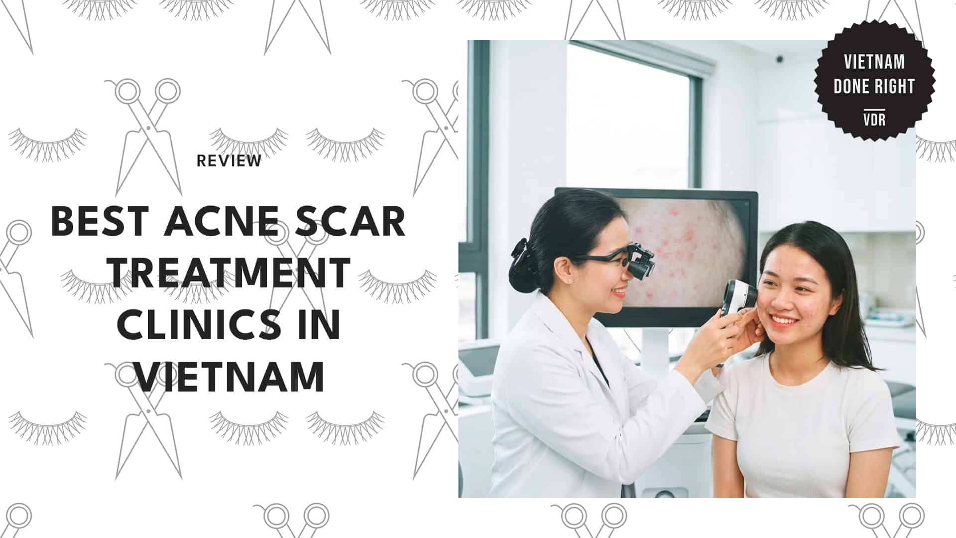 best-acne-scar-treatment-vietnam