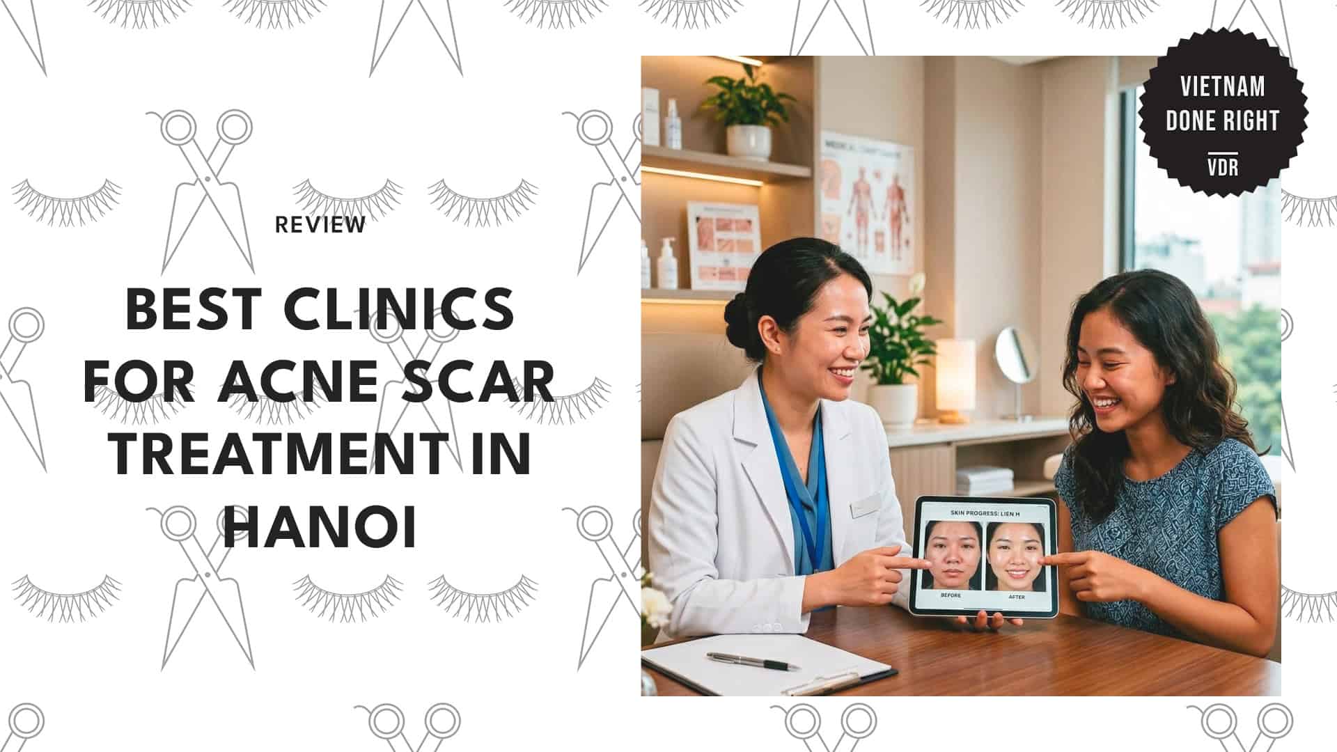 best-acne-scar-treatment-hanoi