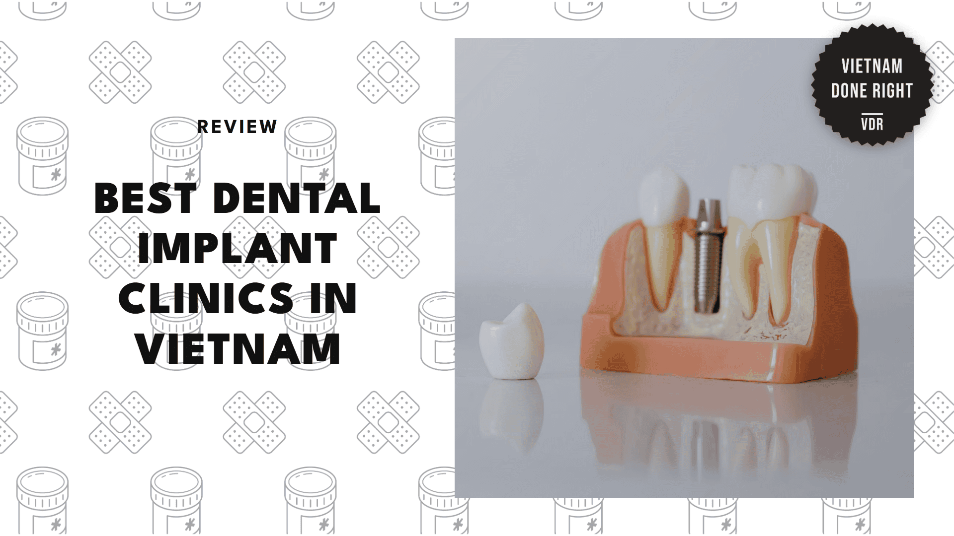 dental-implant-clinics-in-vietnam